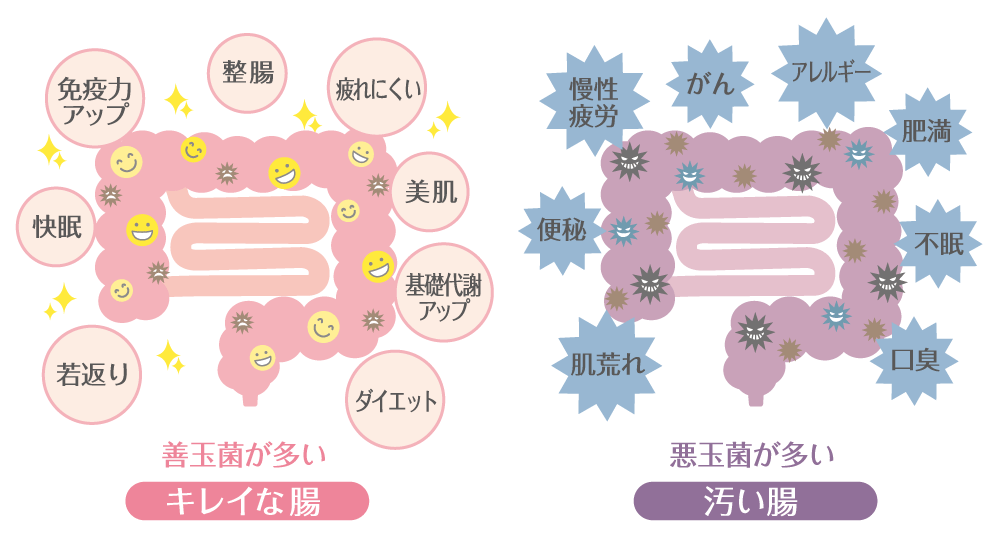 キレイな腸と汚い腸のイラスト