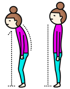 猫背姿勢ビフォーアフター女性イラスト