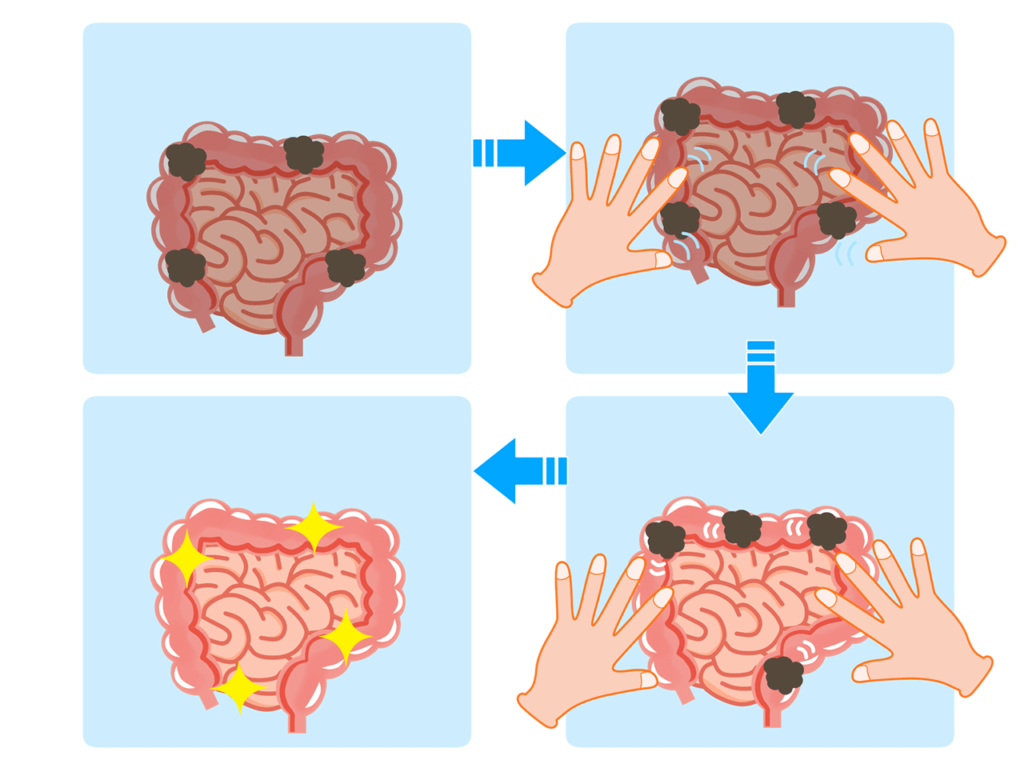 腸のマッサージイラスト